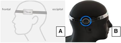 Intracranial pressure waveform in patients with essential hypertension
